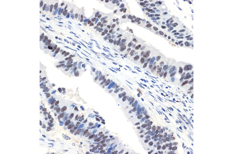 Immunohistochemistry - Anti-NAT10 Antibody [ARC2468] (A306488) - Antibodies.com