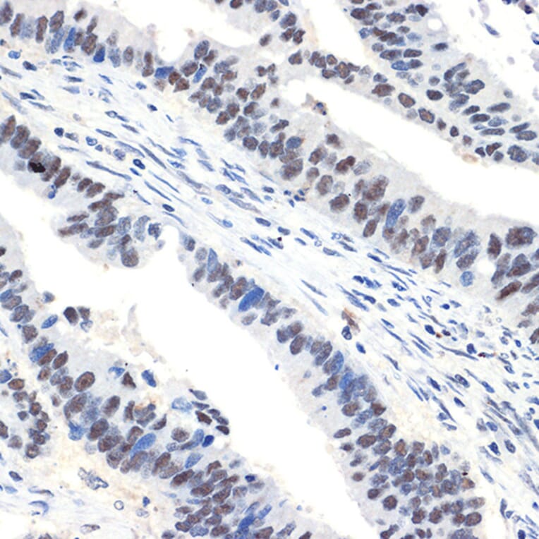 Immunohistochemistry - Anti-NAT10 Antibody [ARC2468] (A306488) - Antibodies.com