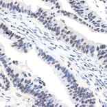 Immunohistochemistry - Anti-NAT10 Antibody [ARC2468] (A306488) - Antibodies.com