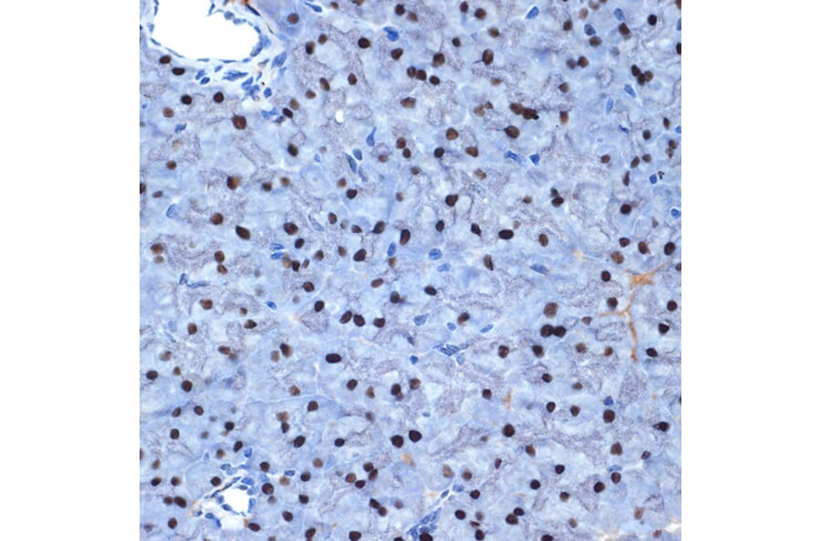 Immunohistochemistry - Anti-NAT10 Antibody [ARC2468] (A306488) - Antibodies.com