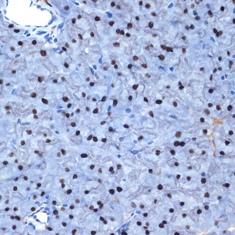 Immunohistochemistry - Anti-NAT10 Antibody [ARC2468] (A306488) - Antibodies.com