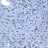 Immunohistochemistry - Anti-NAT10 Antibody [ARC2468] (A306488) - Antibodies.com