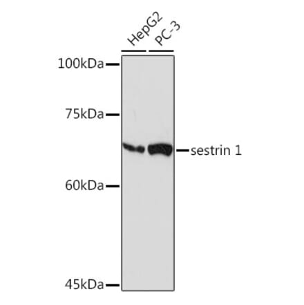 Western Blot - Anti-SESN1 Antibody [ARC2313] (A306490) - Antibodies.com