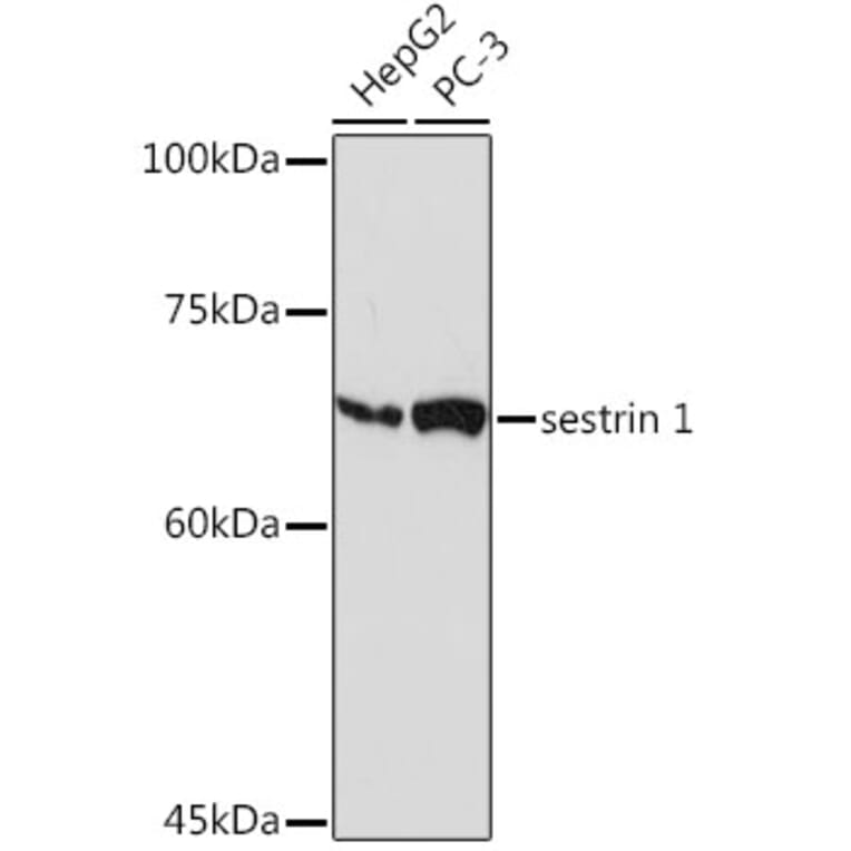 Western Blot - Anti-SESN1 Antibody [ARC2313] (A306490) - Antibodies.com