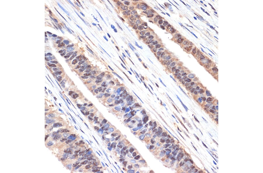 Immunohistochemistry - Anti-SESN1 Antibody [ARC2313] (A306490) - Antibodies.com