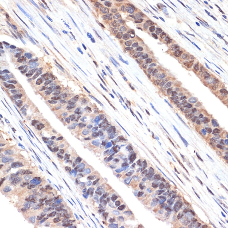 Immunohistochemistry - Anti-SESN1 Antibody [ARC2313] (A306490) - Antibodies.com