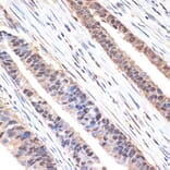 Immunohistochemistry - Anti-SESN1 Antibody [ARC2313] (A306490) - Antibodies.com