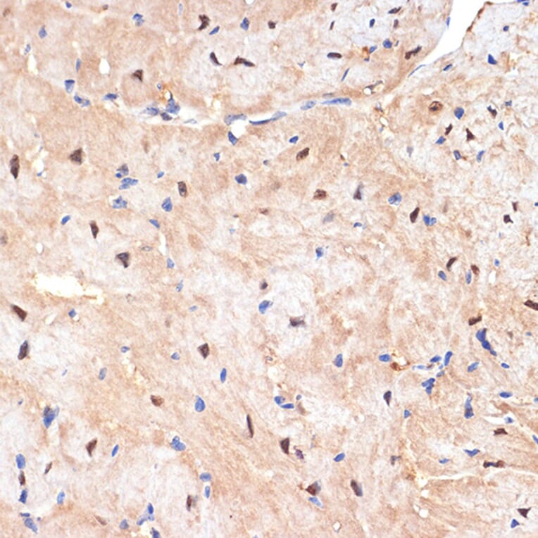 Immunohistochemistry - Anti-SESN1 Antibody [ARC2313] (A306490) - Antibodies.com