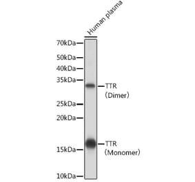 Western Blot - Anti-Prealbumin Antibody [ARC0892] (A306491) - Antibodies.com