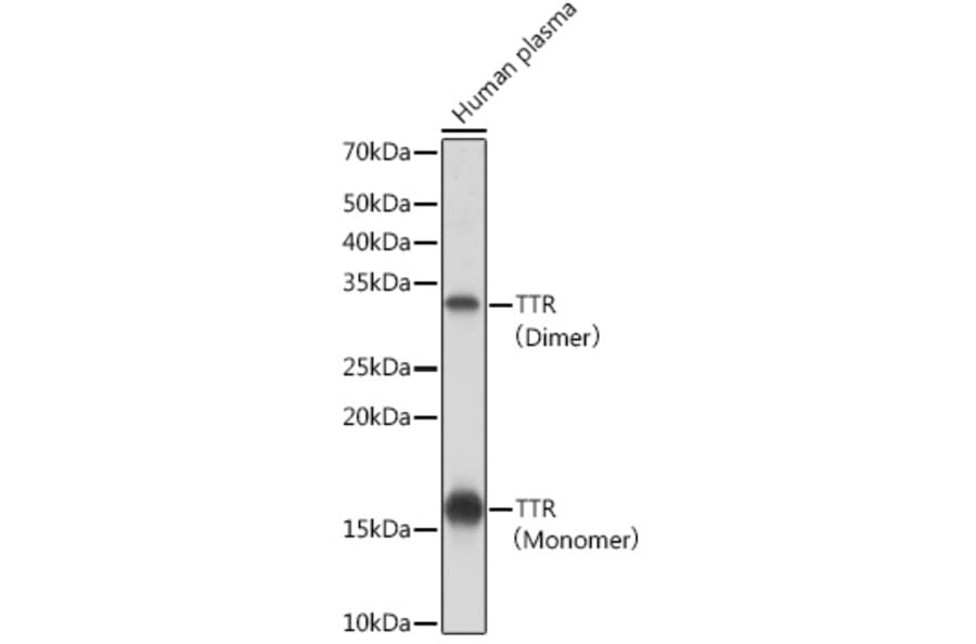 Western Blot - Anti-Prealbumin Antibody [ARC0892] (A306491) - Antibodies.com