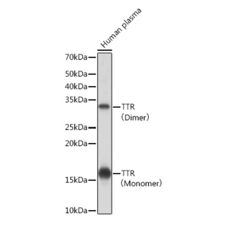 Western Blot - Anti-Prealbumin Antibody [ARC0892] (A306491) - Antibodies.com