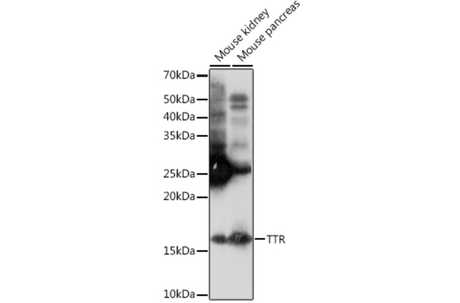 Western Blot - Anti-Prealbumin Antibody [ARC0892] (A306491) - Antibodies.com