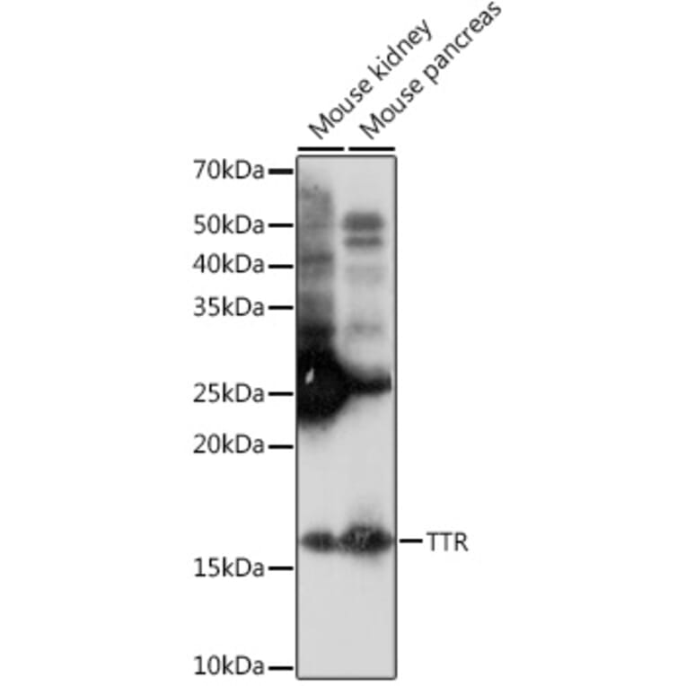 Western Blot - Anti-Prealbumin Antibody [ARC0892] (A306491) - Antibodies.com