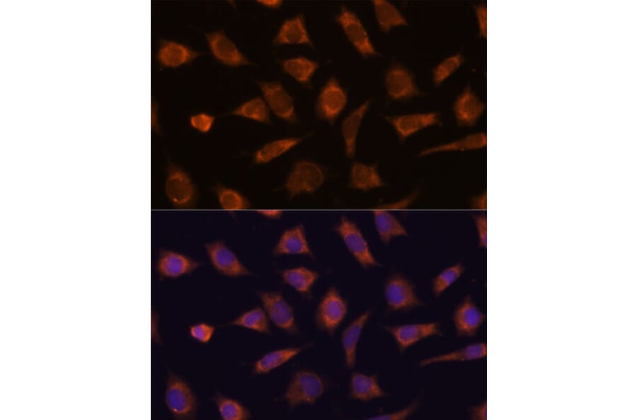 Immunofluorescence - Anti-CAMSAP1 Antibody (A306493) - Antibodies.com