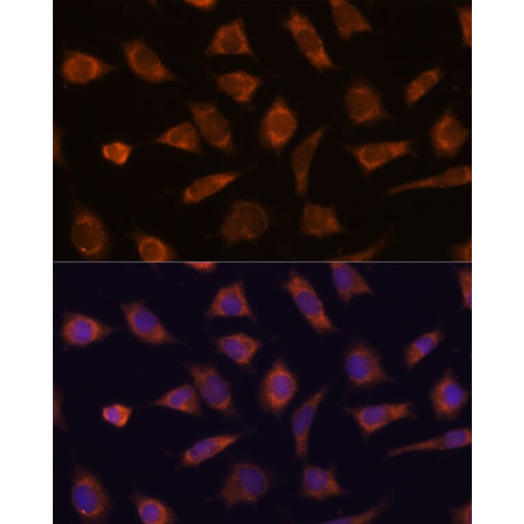 Immunofluorescence - Anti-CAMSAP1 Antibody (A306493) - Antibodies.com