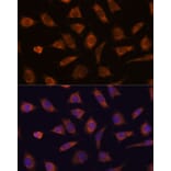 Immunofluorescence - Anti-CAMSAP1 Antibody (A306493) - Antibodies.com