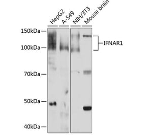 Western Blot - Anti-Interferon alpha/beta receptor 1 Antibody [ARC0262] (A306495) - Antibodies.com