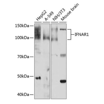 Western Blot - Anti-Interferon alpha/beta receptor 1 Antibody [ARC0262] (A306495) - Antibodies.com