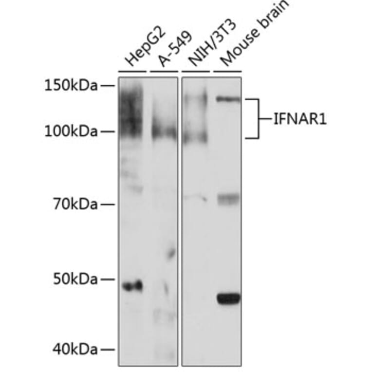 Western Blot - Anti-Interferon alpha/beta receptor 1 Antibody [ARC0262] (A306495) - Antibodies.com
