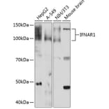 Western Blot - Anti-Interferon alpha/beta receptor 1 Antibody [ARC0262] (A306495) - Antibodies.com