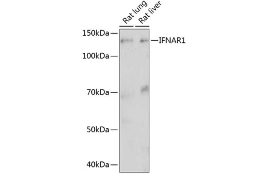 Western Blot - Anti-Interferon alpha/beta receptor 1 Antibody [ARC0262] (A306495) - Antibodies.com
