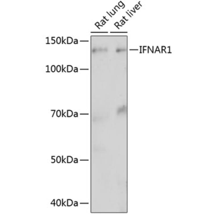 Western Blot - Anti-Interferon alpha/beta receptor 1 Antibody [ARC0262] (A306495) - Antibodies.com