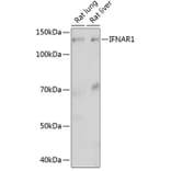 Western Blot - Anti-Interferon alpha/beta receptor 1 Antibody [ARC0262] (A306495) - Antibodies.com