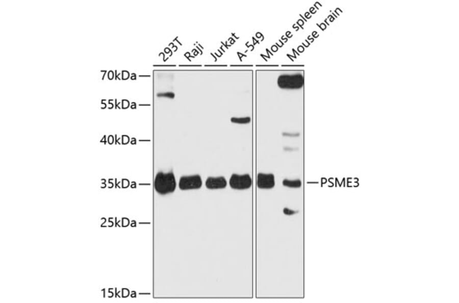Western Blot - Anti-PSME3 Antibody (A306496) - Antibodies.com