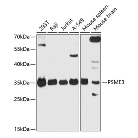 Western Blot - Anti-PSME3 Antibody (A306496) - Antibodies.com