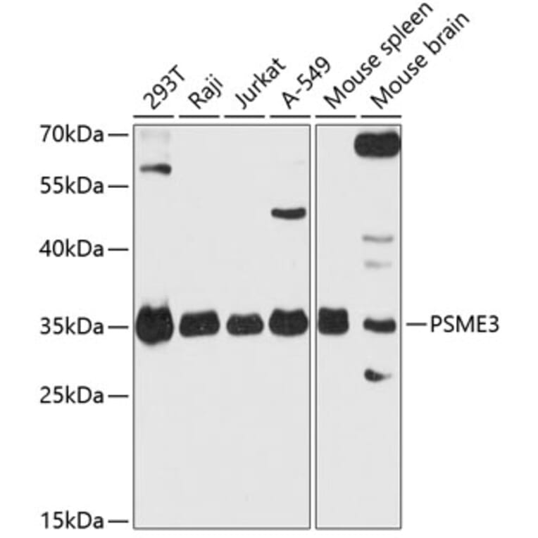Western Blot - Anti-PSME3 Antibody (A306496) - Antibodies.com