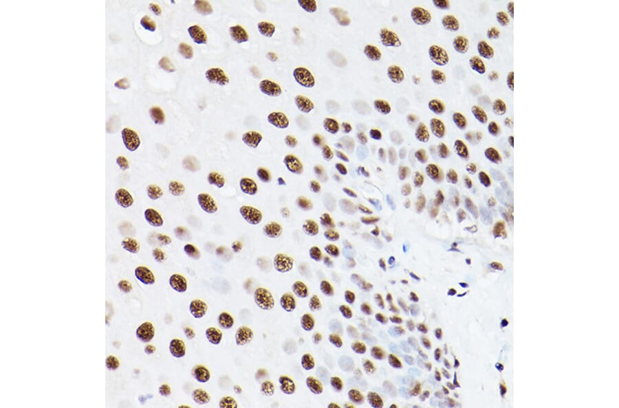 Immunohistochemistry - Anti-PSME3 Antibody (A306496) - Antibodies.com