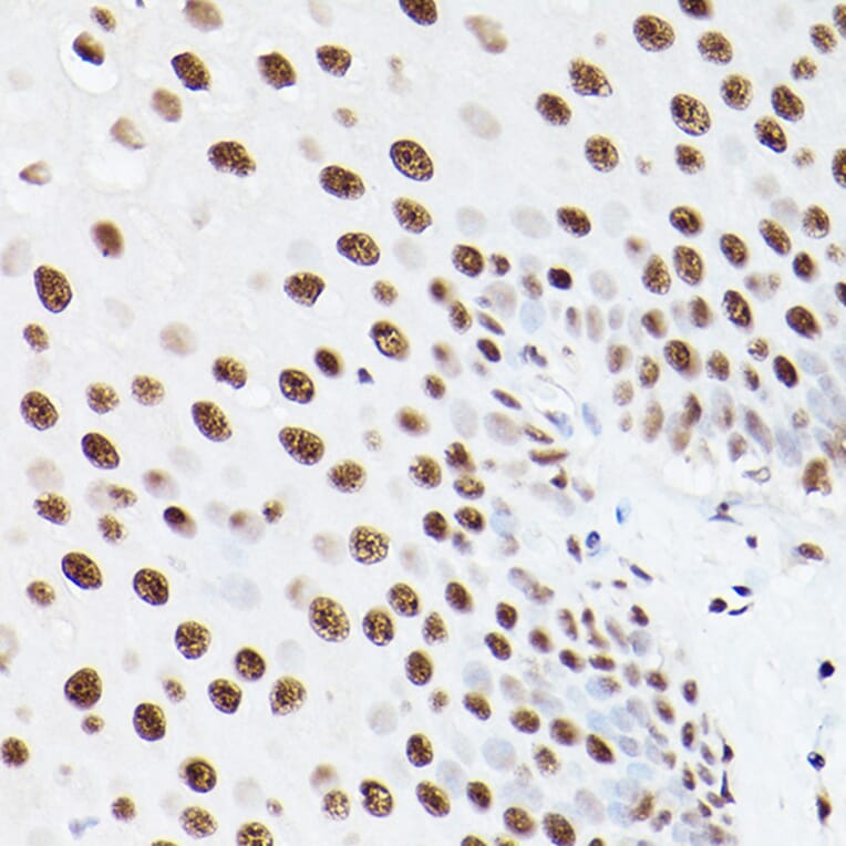 Immunohistochemistry - Anti-PSME3 Antibody (A306496) - Antibodies.com