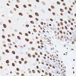 Immunohistochemistry - Anti-PSME3 Antibody (A306496) - Antibodies.com