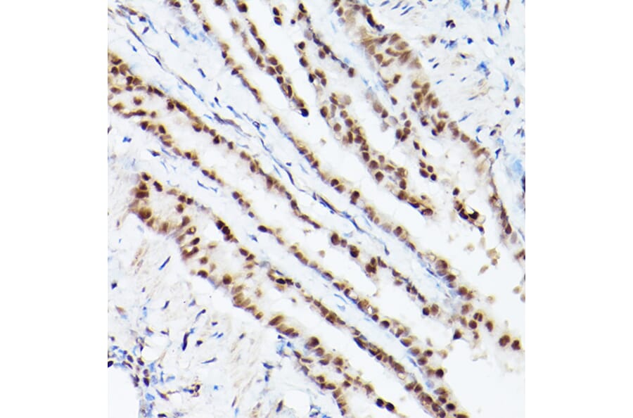 Immunohistochemistry - Anti-PSME3 Antibody (A306496) - Antibodies.com