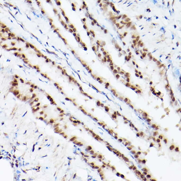 Immunohistochemistry - Anti-PSME3 Antibody (A306496) - Antibodies.com