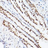 Immunohistochemistry - Anti-PSME3 Antibody (A306496) - Antibodies.com