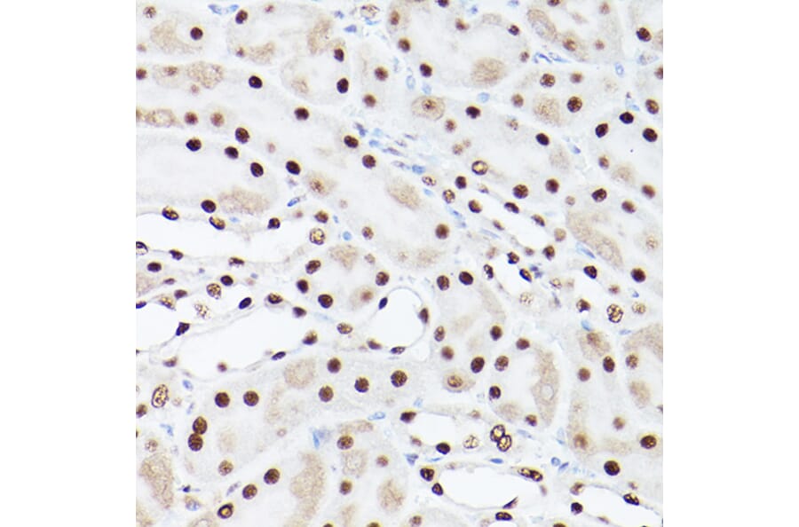 Immunohistochemistry - Anti-PSME3 Antibody (A306496) - Antibodies.com