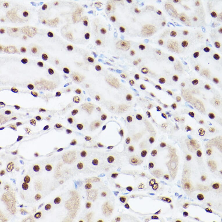 Immunohistochemistry - Anti-PSME3 Antibody (A306496) - Antibodies.com