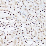 Immunohistochemistry - Anti-PSME3 Antibody (A306496) - Antibodies.com