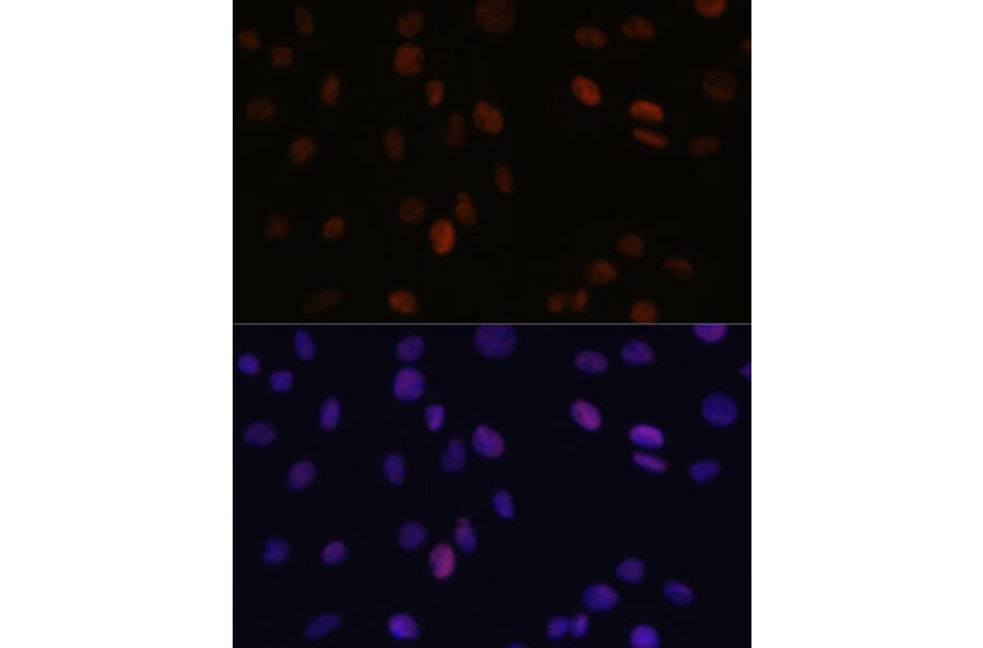 Immunofluorescence - Anti-PSME3 Antibody (A306496) - Antibodies.com
