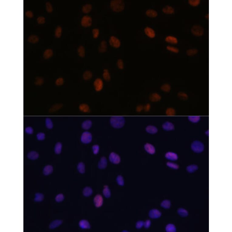 Immunofluorescence - Anti-PSME3 Antibody (A306496) - Antibodies.com