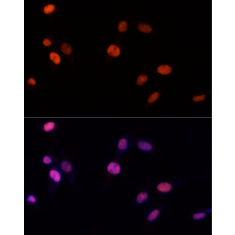 Immunofluorescence - Anti-PSME3 Antibody (A306496) - Antibodies.com