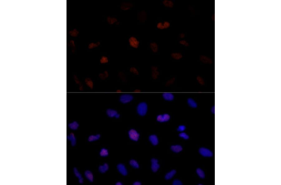 Immunofluorescence - Anti-PSME3 Antibody (A306496) - Antibodies.com