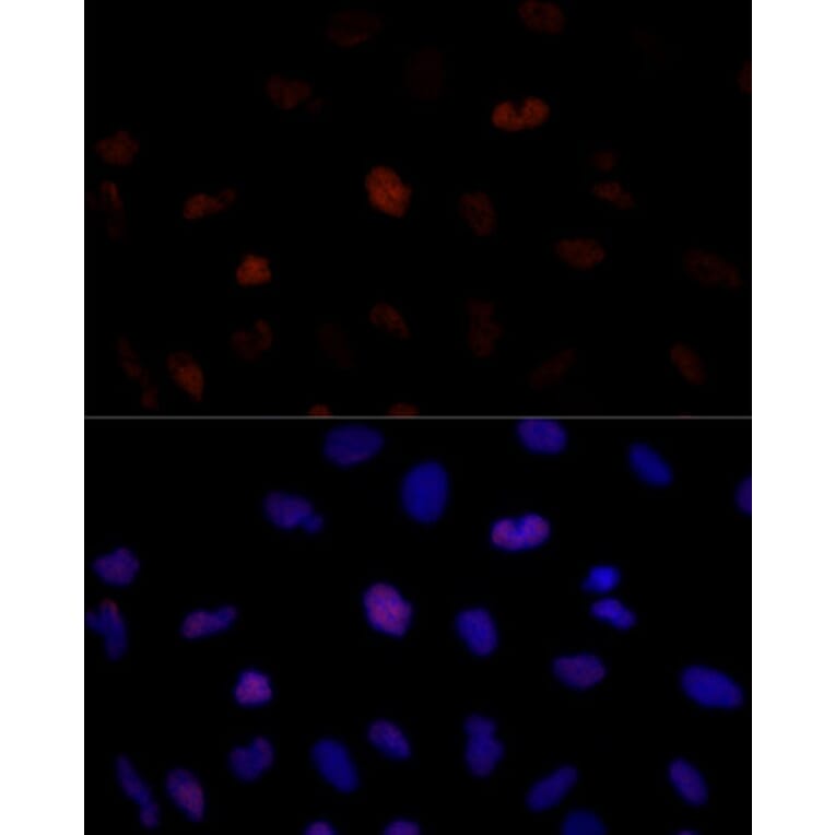Immunofluorescence - Anti-PSME3 Antibody (A306496) - Antibodies.com