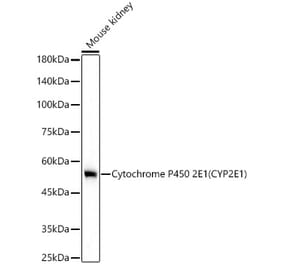 Western Blot - Anti-Cytochrome P450 2E1 Antibody [ARC58001] (A306497) - Antibodies.com