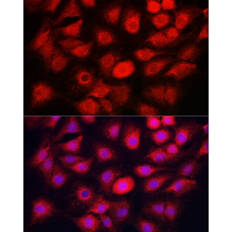 Immunofluorescence - Anti-Caspase-1 Antibody (A306498) - Antibodies.com