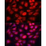 Immunofluorescence - Anti-Caspase-1 Antibody (A306498) - Antibodies.com