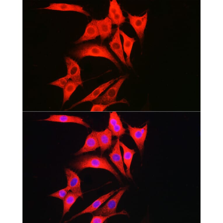 Immunofluorescence - Anti-Caspase-1 Antibody (A306498) - Antibodies.com