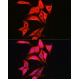 Immunofluorescence - Anti-Caspase-1 Antibody (A306498) - Antibodies.com