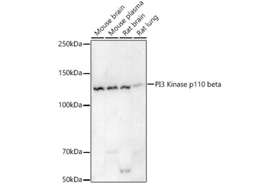 Western Blot - Anti-PI3 Kinase p110 beta Antibody [ARC54484] (A306499) - Antibodies.com